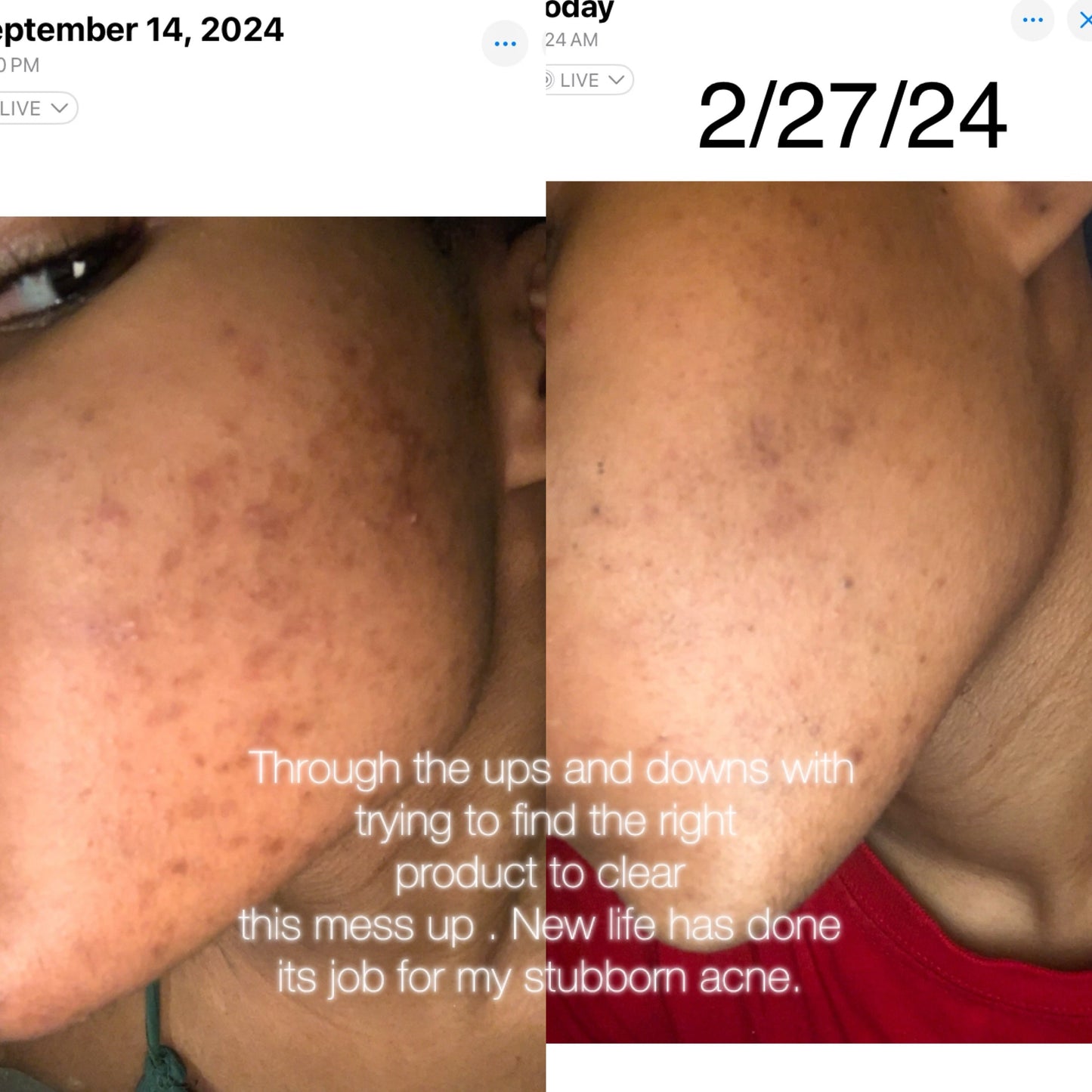 TURMERIC TONER FACIAL SOAP "UNSCENTED"